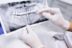 Radiografía Dental